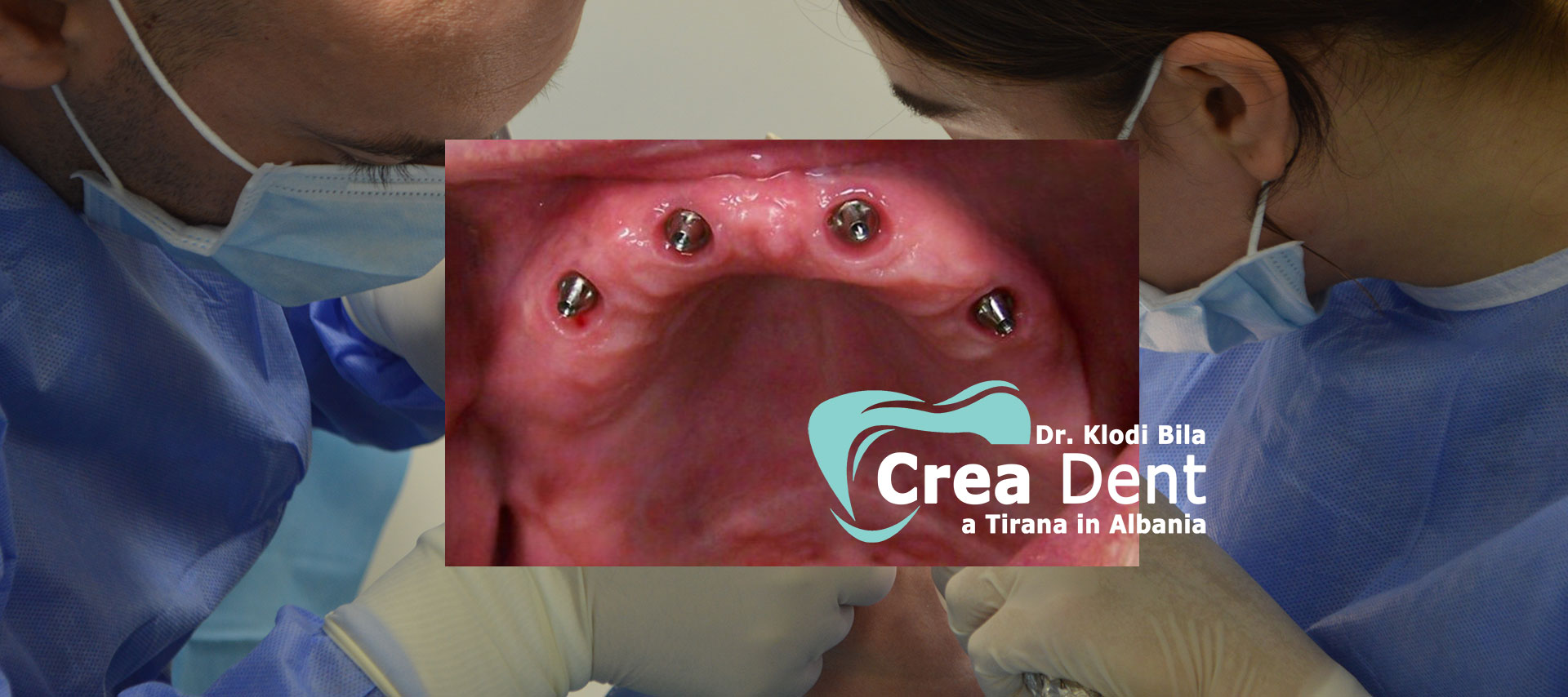 turismo-dentale-in-albania-con-crea-dent.