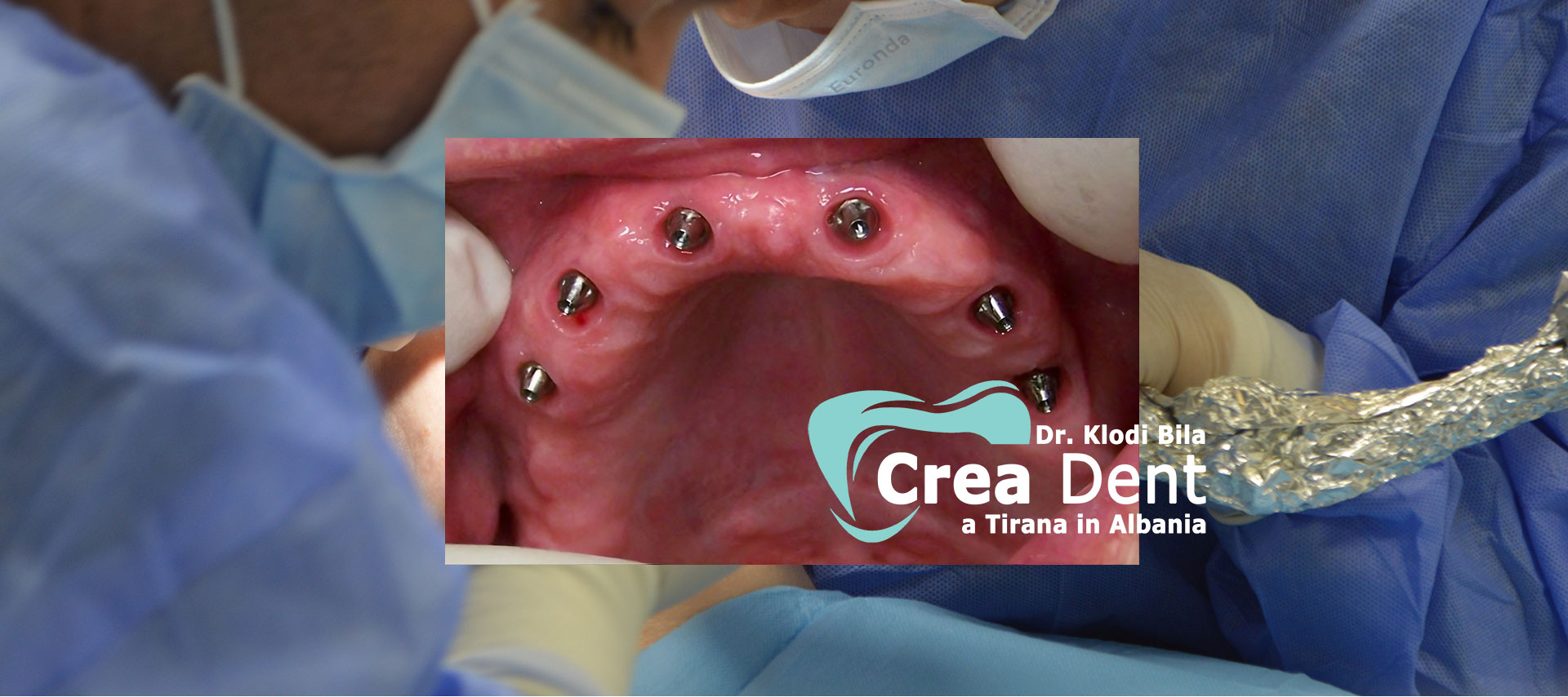 turismo-dentale-in-albania-con-crea-dent.