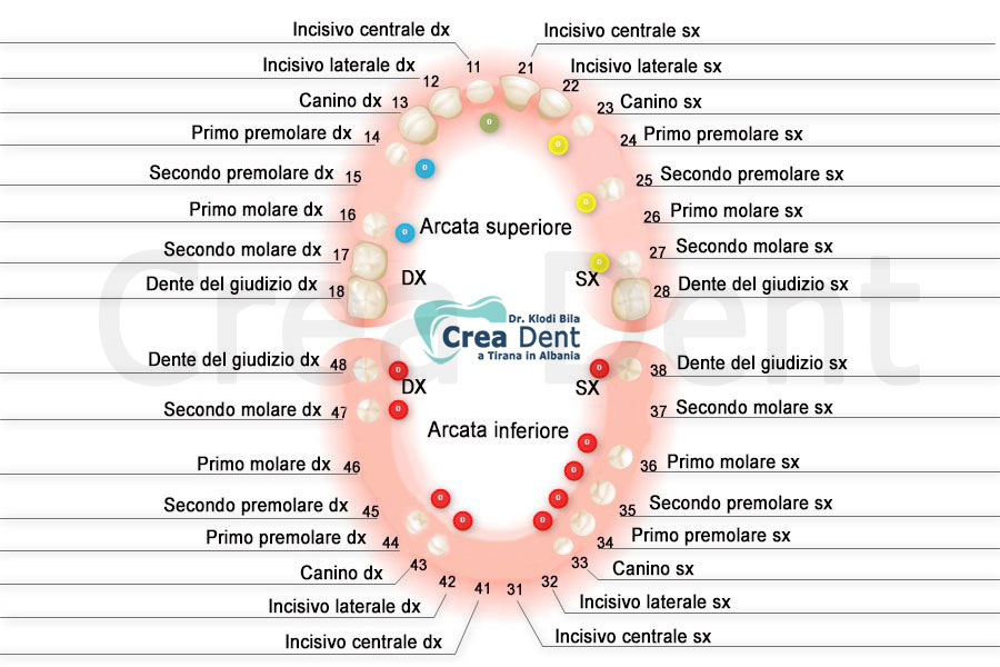 schema-denti-ponti-cementati-su-denti