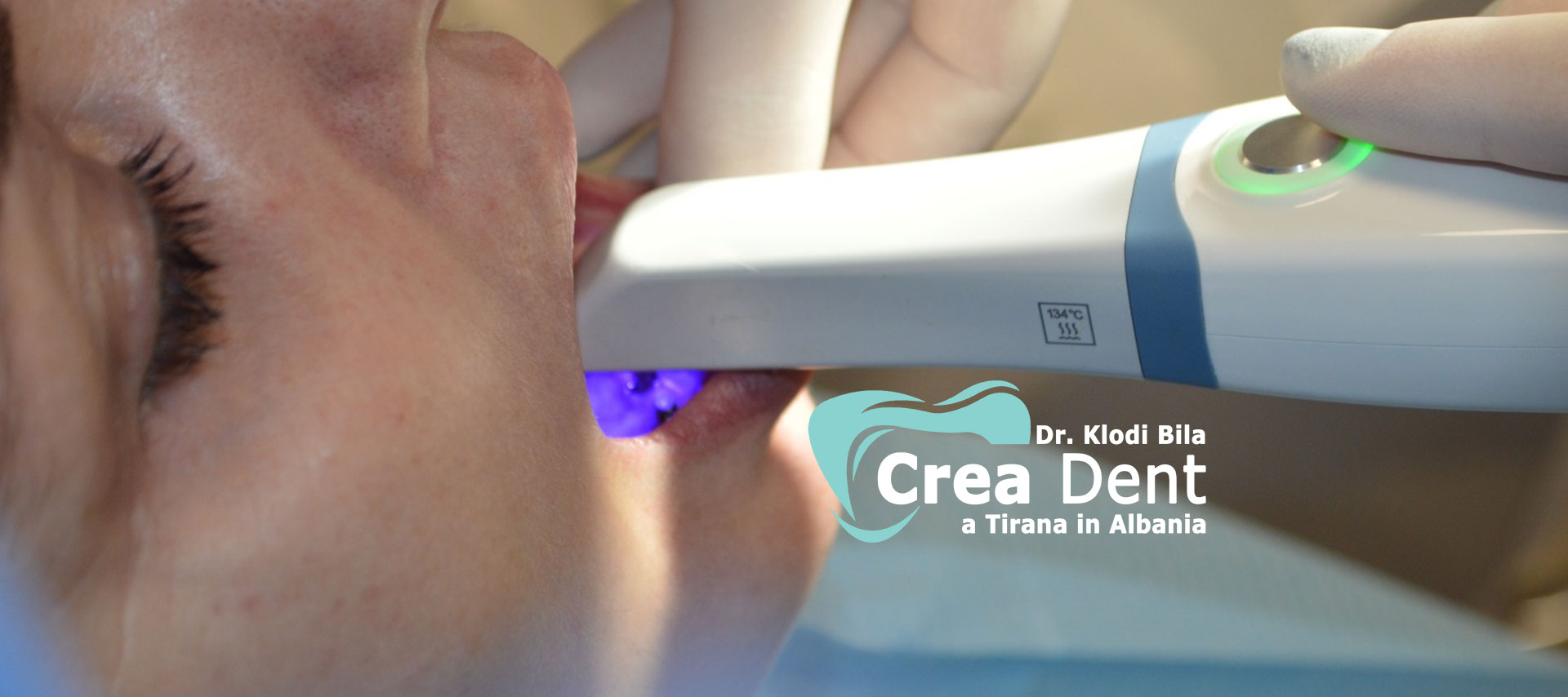il-blog-di-crea-dent