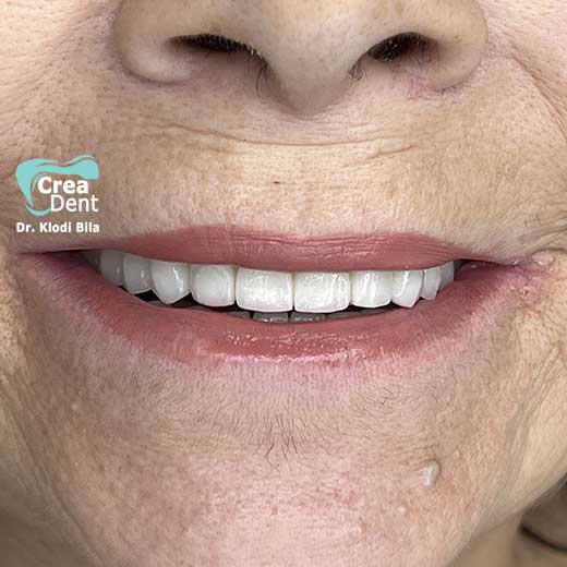 cura-dentale-del-Dr-Klodi-Bile-01
