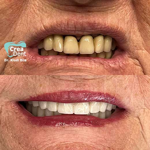 cura-dentale-del-Dr-Klodi-Bile-10