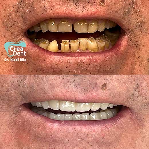 cura-dentale-del-Dr-Klodi-Bile-11