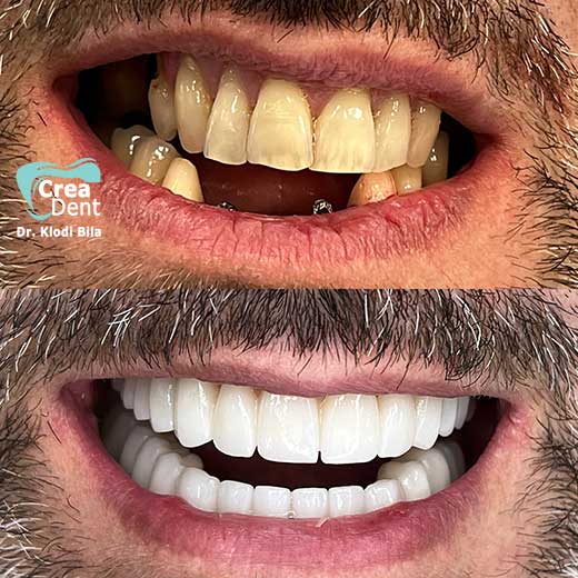 cura-dentale-del-Dr-Klodi-Bile-13