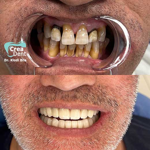 cura-dentale-del-Dr-Klodi-Bile-15