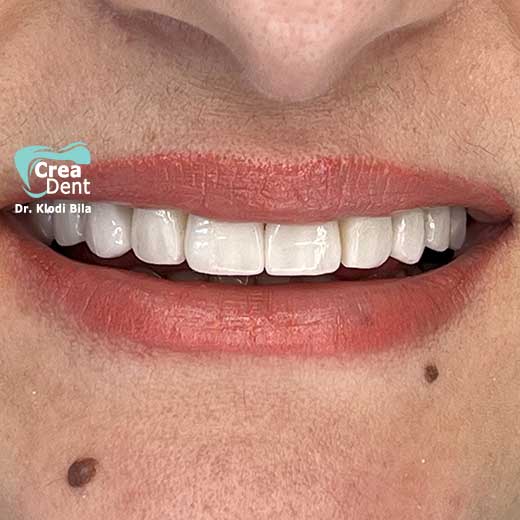 cura-dentale-del-Dr-Klodi-Bile-16