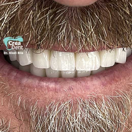 cura-dentale-del-Dr-Klodi-Bile-17