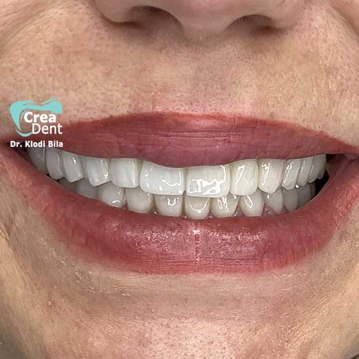 cura-dentale-del-Dr-Klodi-Bile-18
