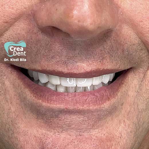 cura-dentale-del-Dr-Klodi-Bile-02