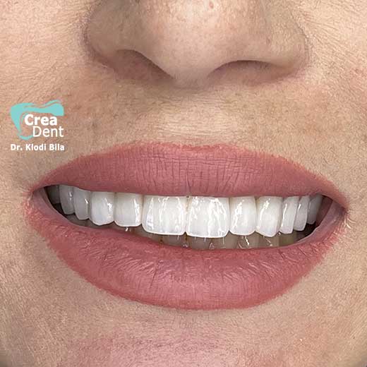 cura-dentale-del-Dr-Klodi-Bile-03