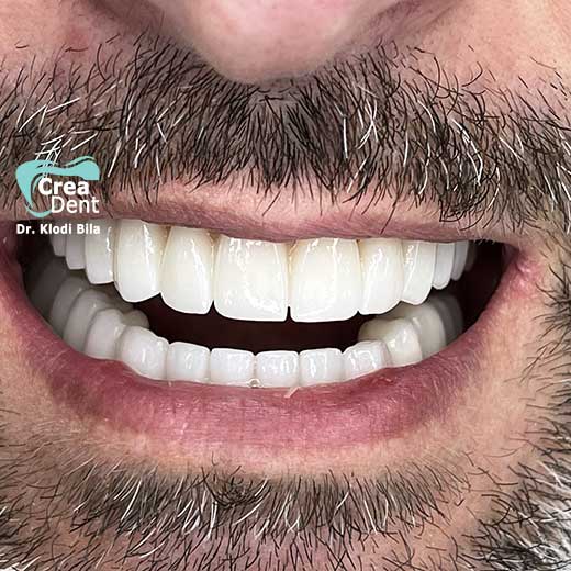 cura-dentale-del-Dr-Klodi-Bile-04