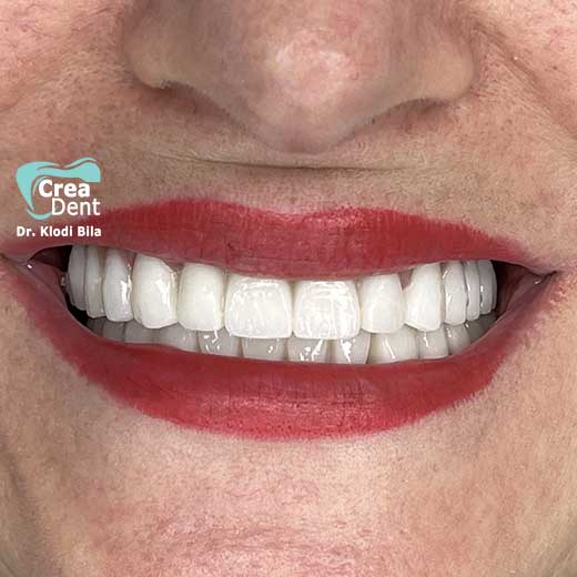 cura-dentale-del-Dr-Klodi-Bile-05