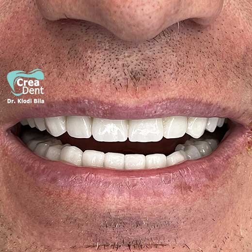 cura-dentale-del-Dr-Klodi-Bile-06