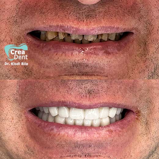cura-dentale-del-Dr-Klodi-Bile-07