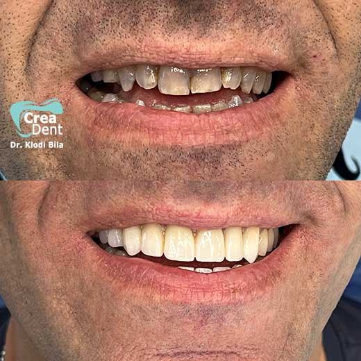cura-dentale-del-Dr-Klodi-Bile-09