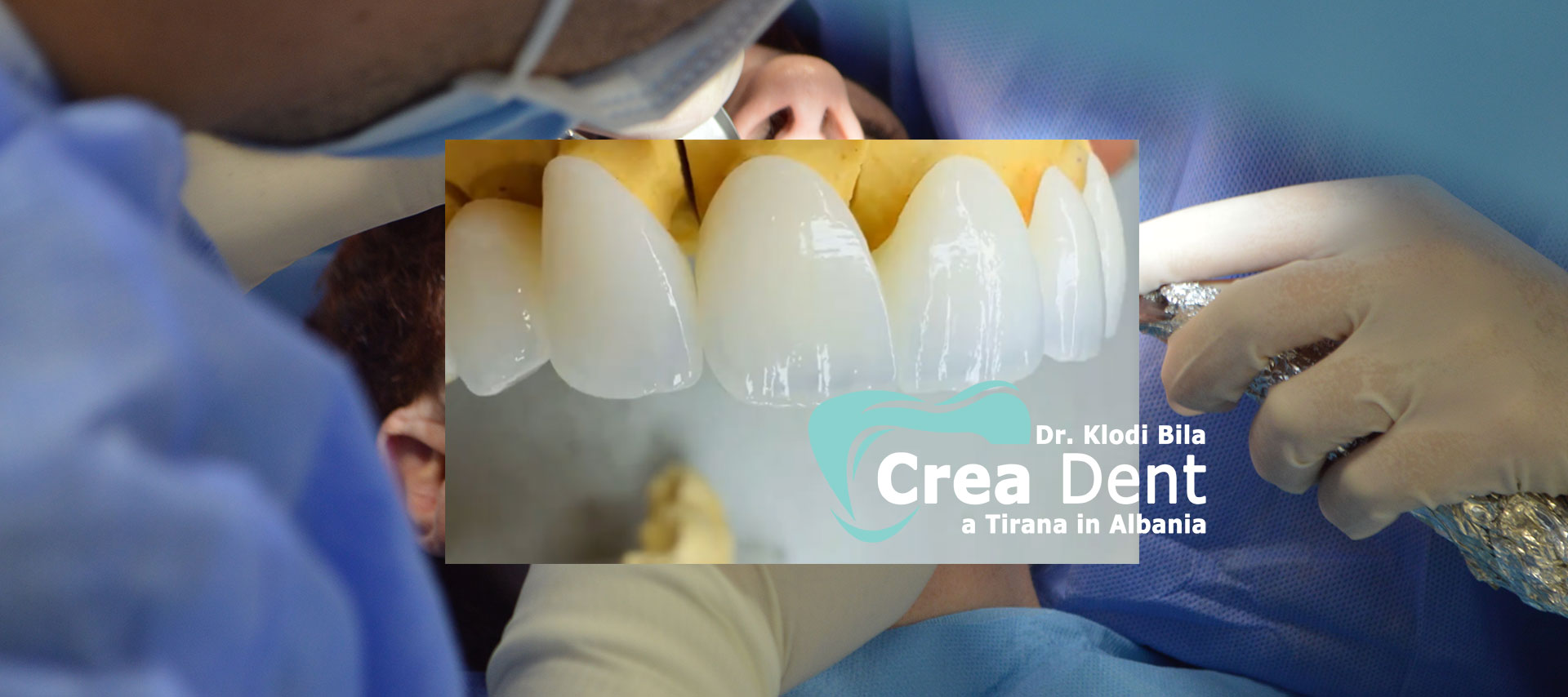 turismo-dentale-in-albania-con-crea-dent.