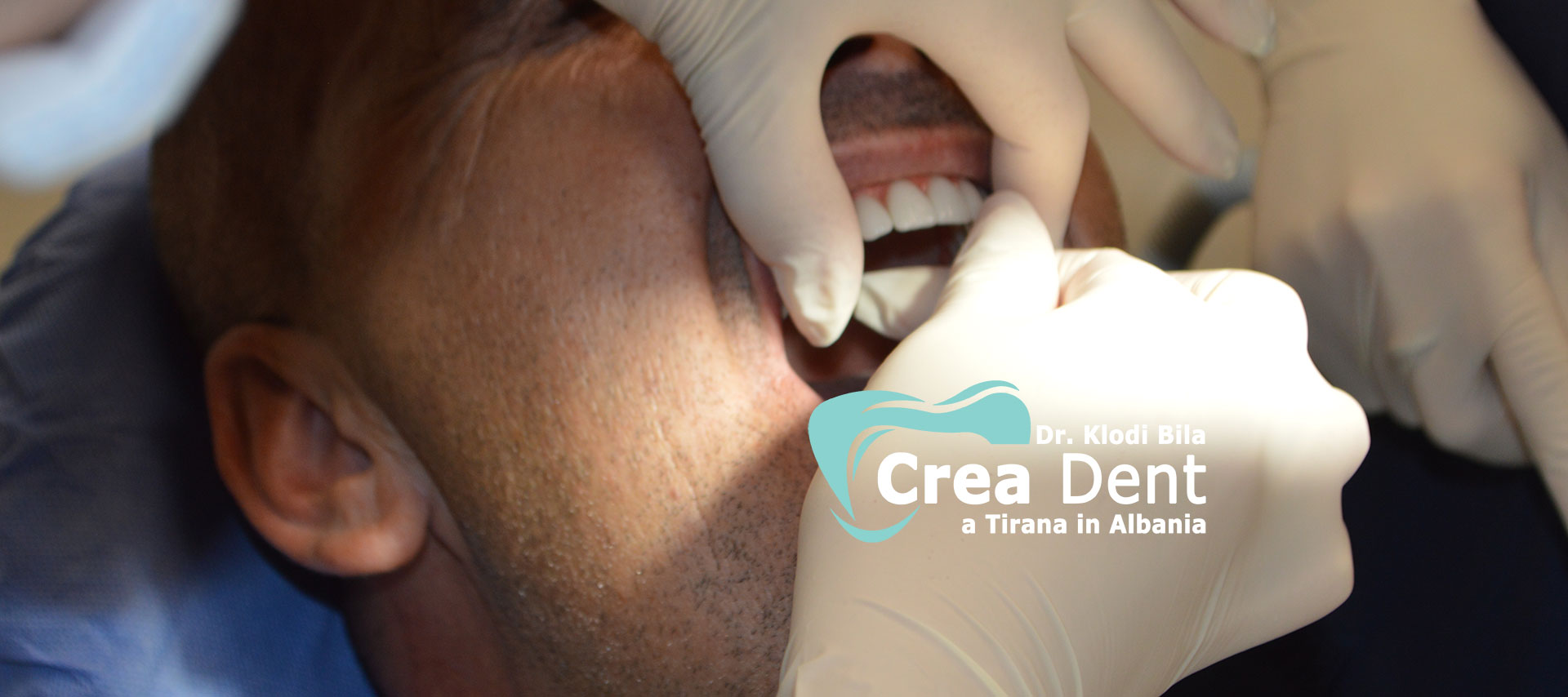 due-pazienti-del-turismo-dentale-con-il dr-klodi-bila.