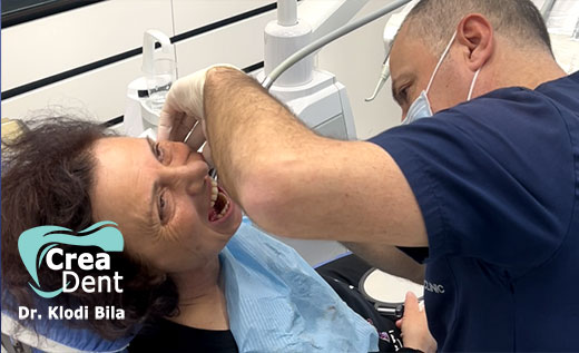impianti-dentali-per-ponte-dentale