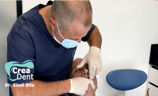 prove-di-applicazione-di-nuove-arcate-dentali-in-zirconio