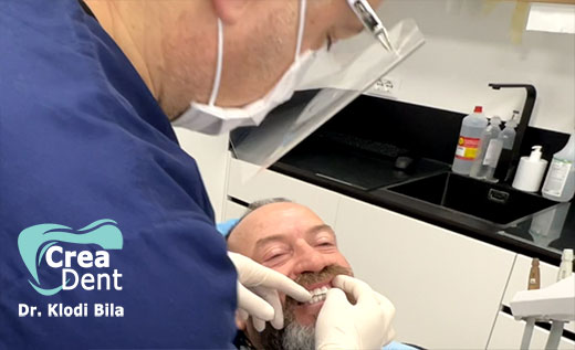 prove-per-le-occlusioni-della-masticazione