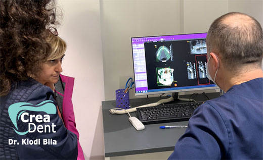 consulenza-per-le-cure-dentistiche-con-la-tac-3d