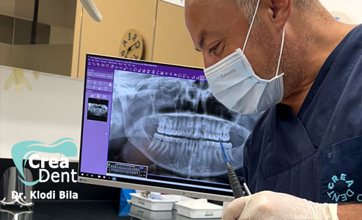 consulenza-per-le-cure-dentistiche-con-la-panoramica-2d