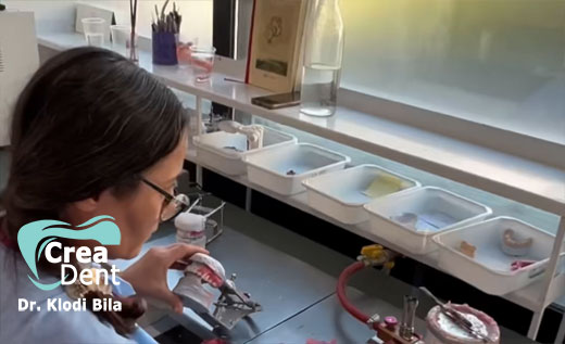 laboratorio-odontotecnico-crea-dent