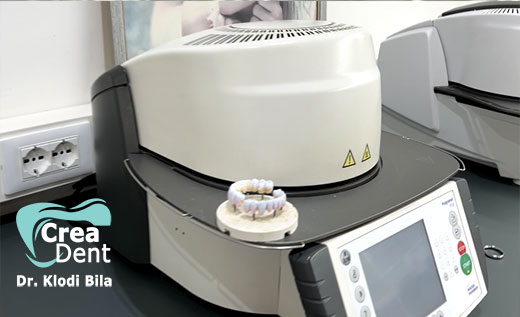 forni-e-attrezzature-per-la-realizzazione-dei-denti-in-zirconio