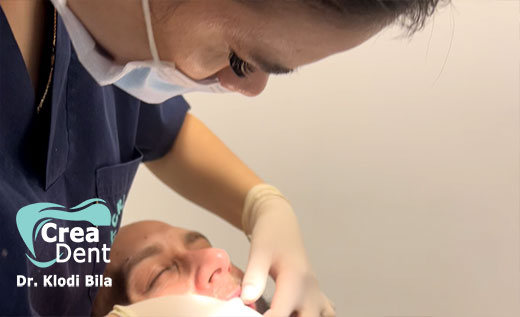 impronta-su-impianti-dentali-per-nuovi-denti-in-zirconio