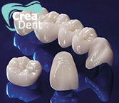 denti-e-ponti-in-zirconio