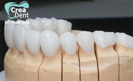 corone-in-zirconio-per-estetica-dentale