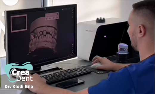 laboratorio-crea-dent