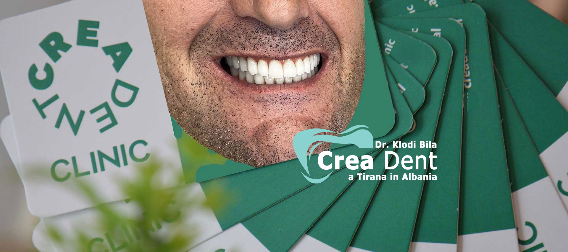 Arcate-dentali-in-zirconio-su-impianti-dentali.