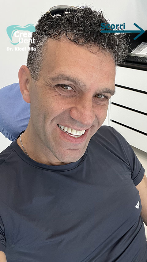 recensione-del-paziente-Roberto-della-clinica-crea-dent-del-dr-klodi-bila