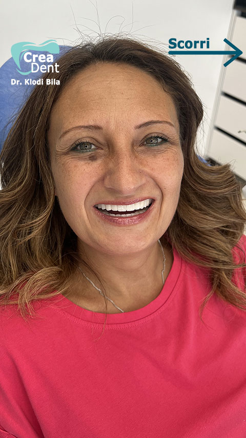 recensione-del-paziente-Carmela-della-clinica-crea-dent-del-dr-klodi-bila