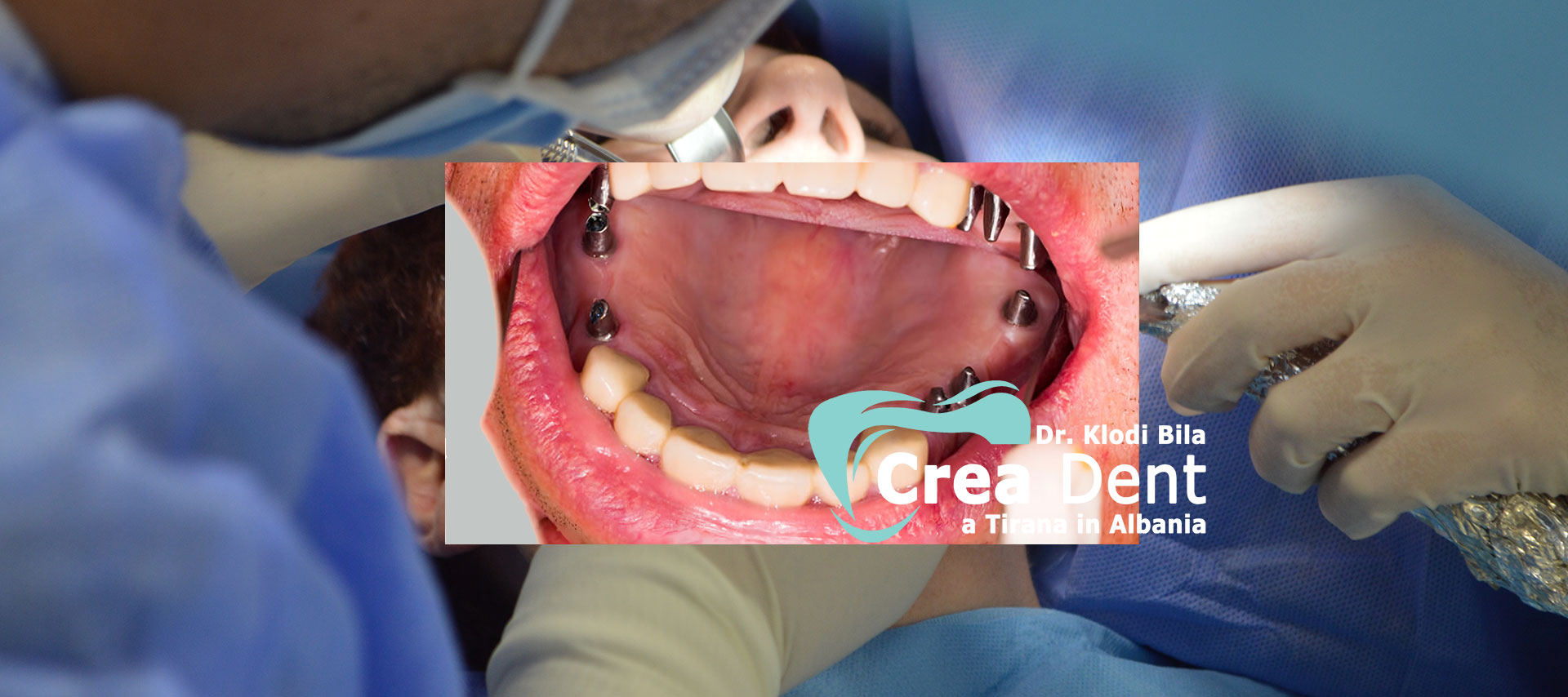 turismo-dentale-in-albania-con-crea-dent.