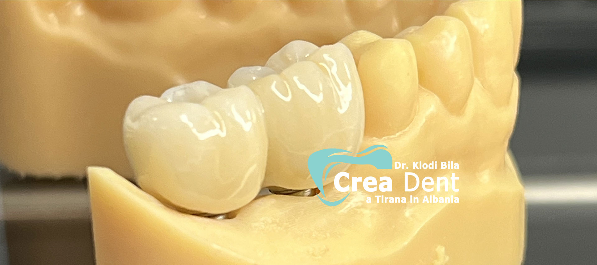 due-pazienti-del-turismo-dentale-con-il dr-klodi-bila.