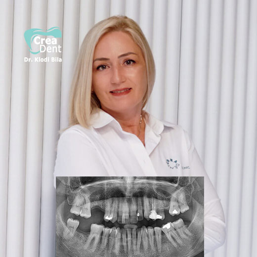 invio-della-panoramica-dentale-a-crea-dent